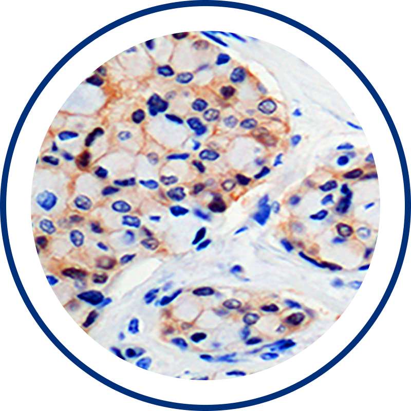 Identifying new oncogenic drivers